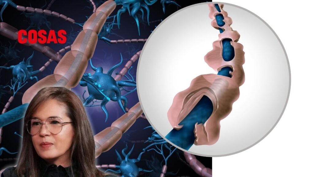 Yolanda Andrade enfrenta síntomas severos por esclerosis múltiple y busca atención médica especializada.